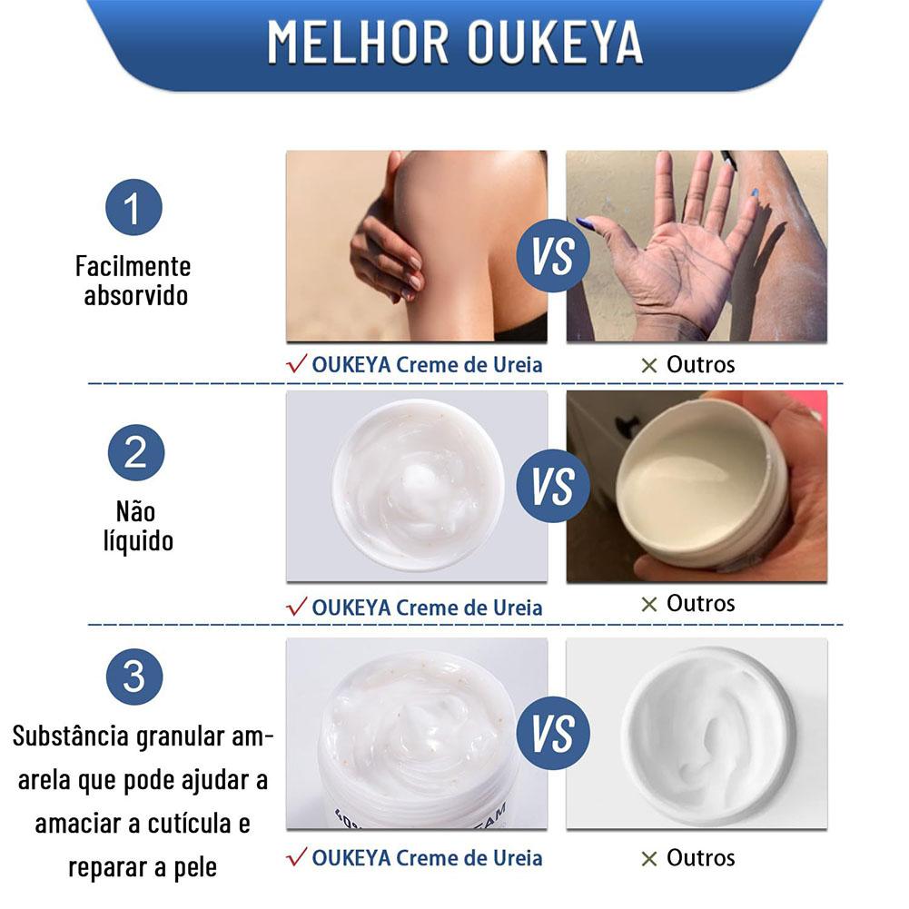 Urea Cream 40% Moisturizing An - огляд і ціна Urea Foot Cream