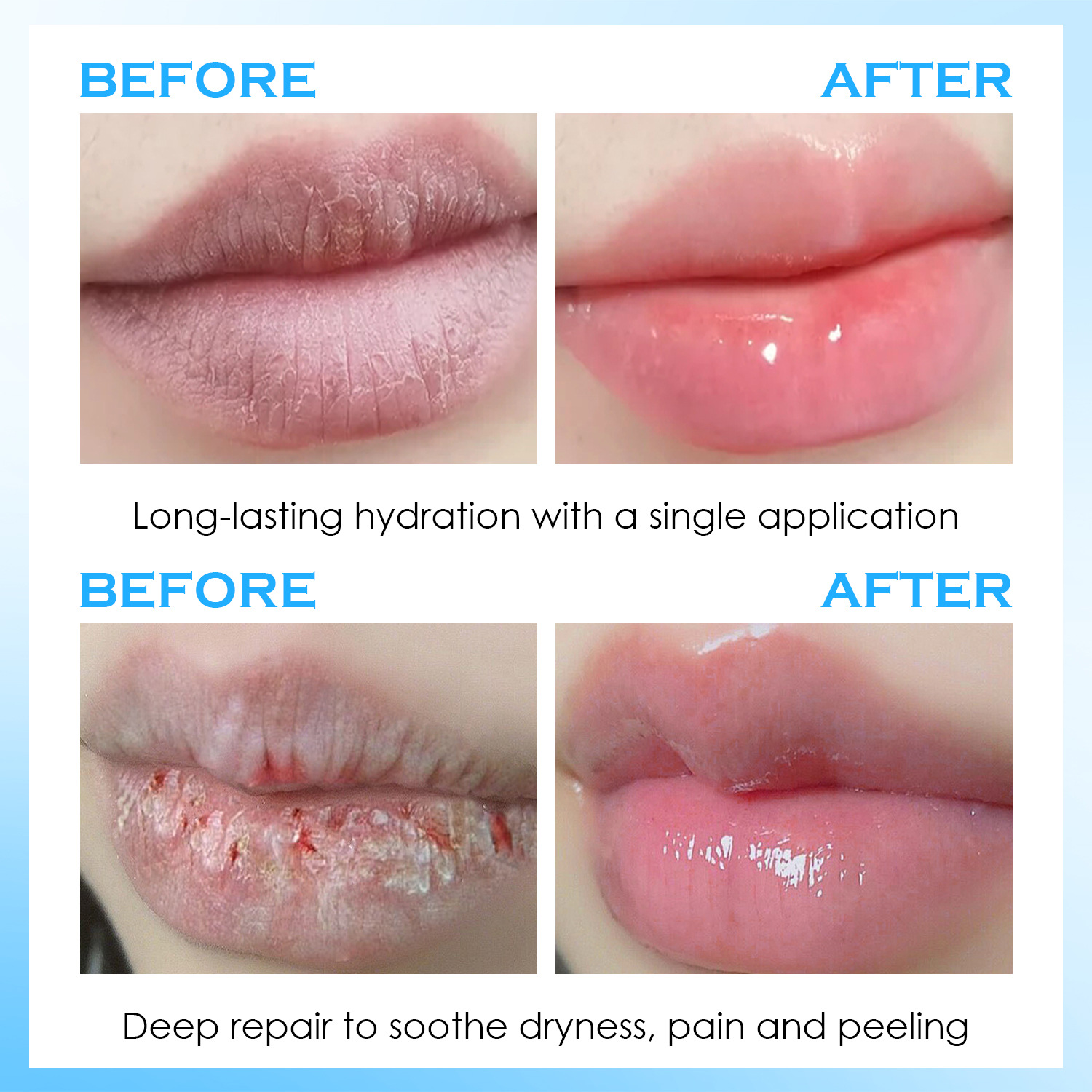 Lip Serum Moisturizing Balm Hy - огляд і ціна Lip Balm