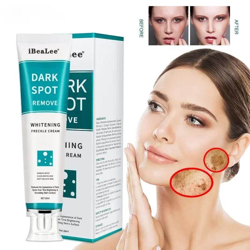 Whitening Freckle Cream Remove - огляд і ціна Skincare Glowing