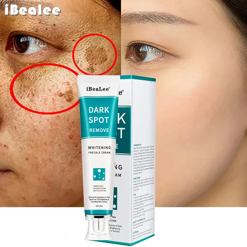 Whitening Freckle Cream Remove - огляд і ціна Skincare Glowing