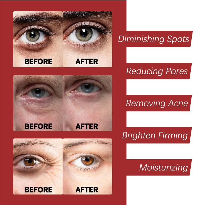 Retinol Cream  Moisturizing Sk - огляд і ціна Retinol Cream