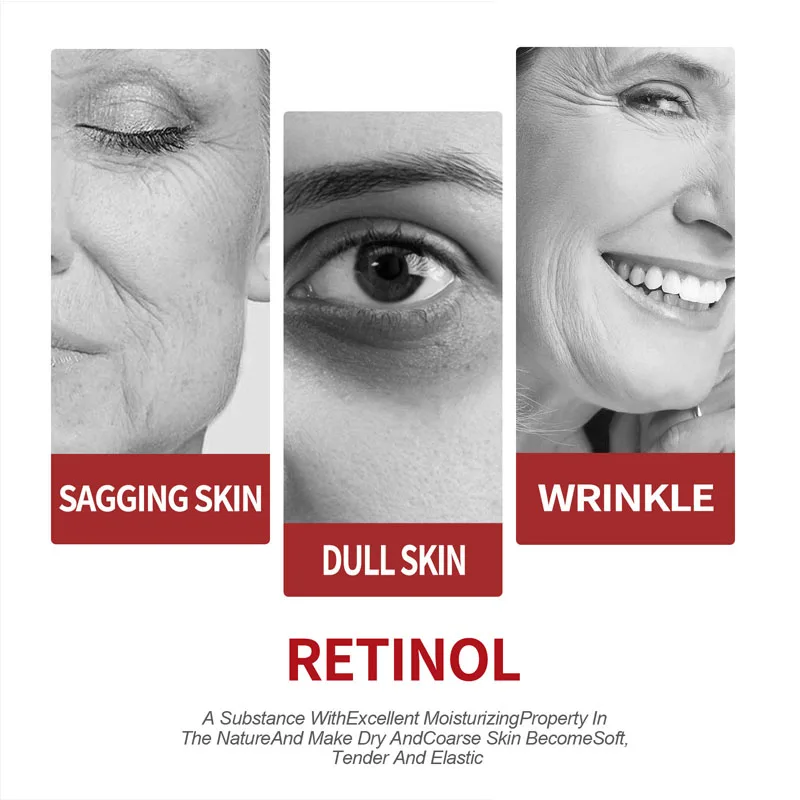 Retinol Cream  Moisturizing Sk - огляд і ціна Retinol Cream